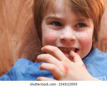 Red-haired Freckled Boy Portrait. Child Biting Nails With Teeth