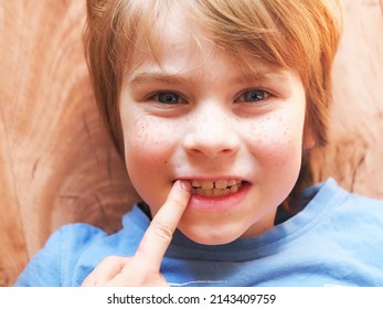 Red-haired Freckled Boy Portrait. Child Biting Nails With Teeth