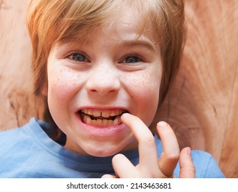 Red-haired Freckled Boy Portrait. Child Biting Nails With Teeth