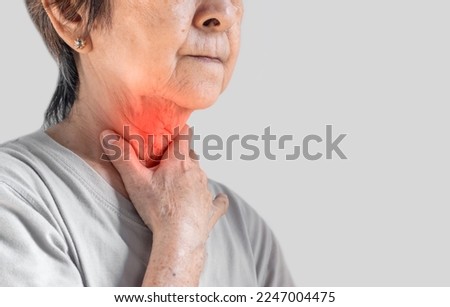 Redness at the neck of Asian, Myanmar woman. Concept of sore throat, pharyngitis, laryngitis, esophagitis, thyroiditis, or dysphagia.