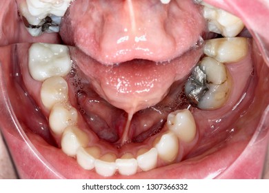 Reflected Oral Cavity