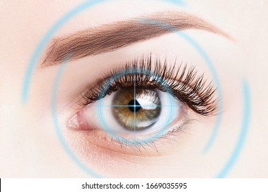 Refractive surgery, eye laser surgery concept. Female eye close up with blue laser rays.