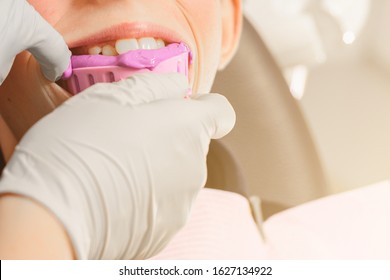 Registration of impressions and bites in a young teenager. Functional modern dental diagnostics. - Shutterstock ID 1627134922