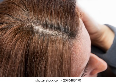 Regrown Dark Gray Hair Roots. Taking Care Of Yourself In Adulthood. Close-up.