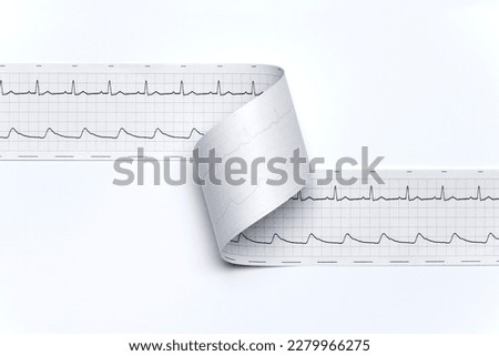Regular print out elektrocardiogram, ecg, on white background close up