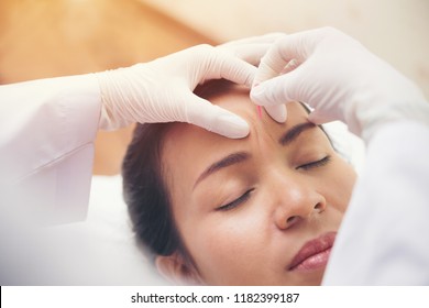 Relaxed Young asian Woman Receiving Acupuncture Treatment In Beauty Spa