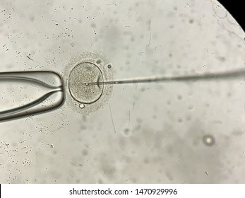Remarkable macro view through the microscope at process of the in vitro fertilization of a female egg inside IVF dish in the laboratory. Horizontal. - Shutterstock ID 1470929996