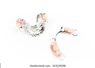 removable partial denture on white background.