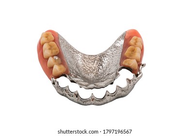 Removable partial metal denture swinglock type on white background with clipping path.