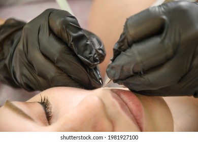 Removal of facial hair of a woman using metod electro epilation. Process removal hair permanently using electrolysis. Doctor in black gloves working in cosmetic medical cabinet. Close up.