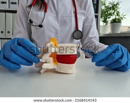 Removal of intervertebral hernia operation risks. Doctor holding scalpel and spine concept
