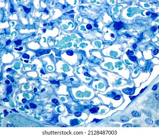 Renal Cortex. 0.5 µm Thick Section Of Material Embedded In Plastic, Stained With Toluidine Blue. Renal Corpuscle Showing Capillary Loops Of The Vascular Tuft With Red Blood Cells In Their Lumen