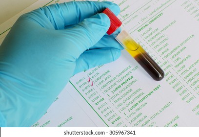 Renal Function Test