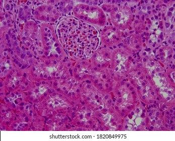 
Renal Glomerulus Surrounded By Tubules In A Sample Stained With Hematoxylin Eosin