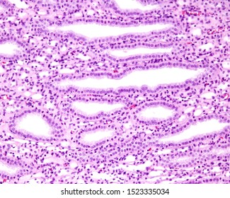 Renal Medulla Showing Collecting Ducts Lined By A Simple Columnar Epithelium. Among Them, They Are Many Cross-sectioned Capillaries And Henle's Loops.