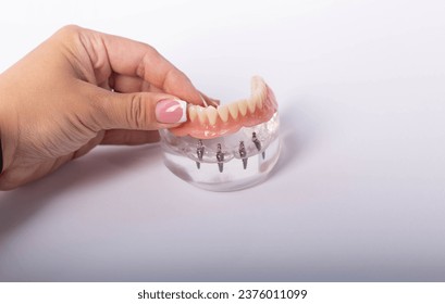 render of mandibular prosthesis all on 4 system supported by implants over white background