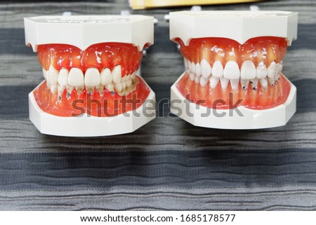 replica teeth from top view 