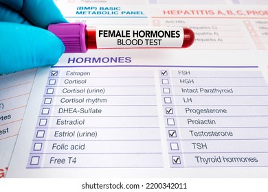 Requisition Form With Blood Test Check For Study Of Levels Of Hormones For Woman. Doctor Holding Blood Sample For Analysis Of Female Hormones Test