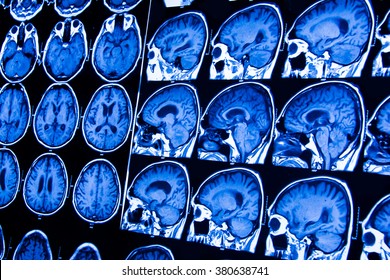 11,340 Mri brain scan Images, Stock Photos & Vectors | Shutterstock