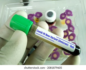 Researcher Hold Blood Sample For New Variant Of The Covid-19 Omicron B.1.1.529 Test. A Generic Of Covid-19 Coronavirus Mutations. Doctor In Analysis Lab Holding Sample Of New Strain Of Covid Omicron