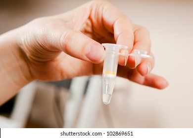 Researchers Bare Hand Holding Eppendorf Test Stock Photo Edit Now