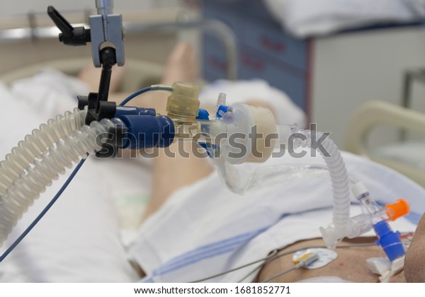 Respiratory
connection tube, HME filter and suction catheter, patient connected
to medical ventilator in ICU in hospital.
