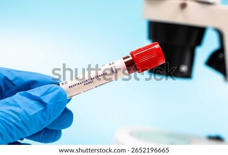 Respiratory Pathogen Panel Blood Samples in test tube for microbiological research