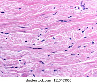 The reticular dermis is a dense irregular connective tissue with fibroblasts and densely packed collagen fibers, organized in intertwined fascicles. High magnification micrograph.