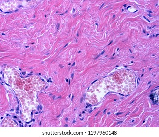 The Reticular Dermis Is A Dense Irregular Connective Tissue With Densely Packed Collagen Fibers. Some Small Blood Vessels (venules) Can Also Be Seen.