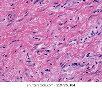 The Reticular Dermis Is A Dense Irregular Connective Tissue With Densely Packed Collagen Fibers. Some Small Blood Vessels Can Also Be Seen .