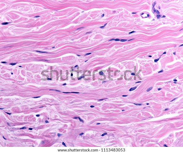 Reticular Connective Tissue Structure