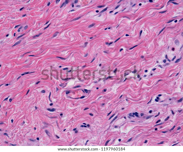 The reticular dermis is a dense irregular\
connective tissue with densely packed collagen fibers. Some small\
blood vessels can also be seen\
.