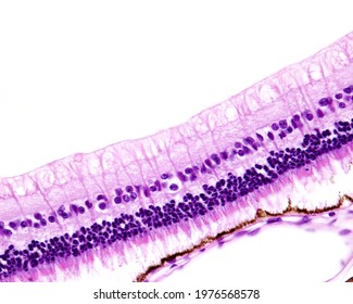 Retina Layers. From Bottom To Top: Pigment Epithelium, Rods And Cones, Outer Nuclear, Outer Plexiform, Inner Nuclear, Inner Plexiform, Ganglion Cell, And Nerve Fiber Layers.