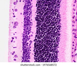 Retina layers. From left to right: pigment epithelium (little pigmented), rods and cones, outer nuclear, outer plexiform, inner nuclear, inner plexiform, ganglion cell, and nerve fiber layers.