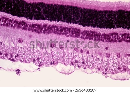 Retina layers, light micrograph. From top to bottom: rods and cones, outer nuclear, outer plexiform, inner nuclear, inner plexiform, ganglion cell (with large neurons), and optic nerve fibre layers.