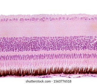 
Retina layers. From top to bottom: nerve fiber, ganglion cell, inner plexiform, inner nuclear, outer plexiform, outer nuclear, rods and cones, and pigment epithelium layers. (Bird retina)