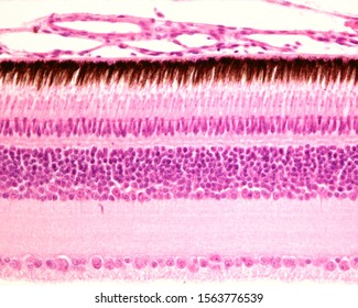 Retina layers. From top to bottom : nerve fiber, ganglion cell, inner plexiform, inner nuclear, outer plexiform, outer nuclear, rods and cones, and pigment epithelium layers. (Bird retina)