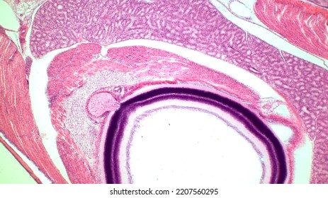 Retina And Optic Nerve. Haematoxylin End Eosin Stain.