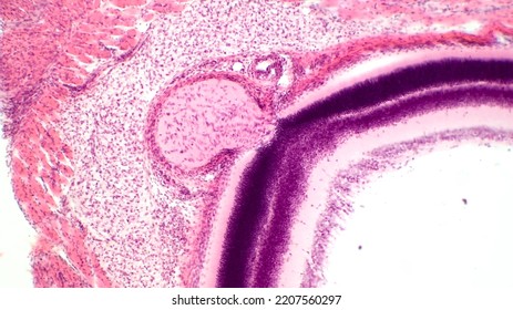 Retina And Optic Nerve. Haematoxylin End Eosin Stain.