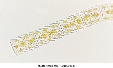 Rhabdonema, A Marine Phytoplankton From Diatom Group. Marine Golden Algae. Lugol-fixed Sample. 400x Magnification