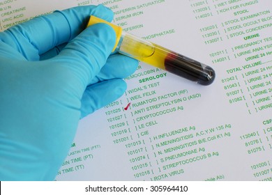 Rheumatoid Factor Testing