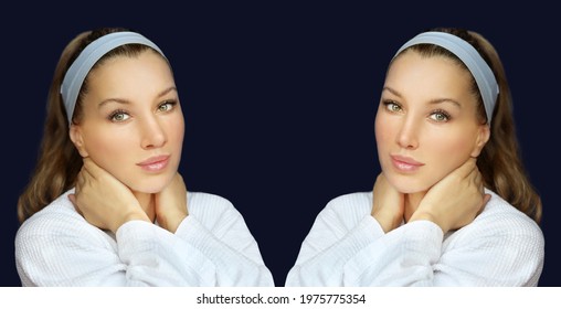 Rhinoplasty,septoplasty. Before And After Correction