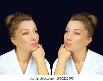 Rhinoplasty,septoplasty. Before And After Correction