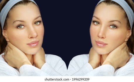 Rhinoplasty,septoplasty. Before And After Correction