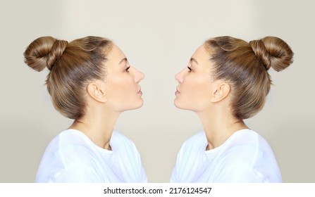 Rhinoplasty,septoplasty. Before And After Correction