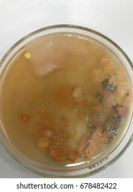 Rhizobium Bacteria In Soil On The Culture Dish