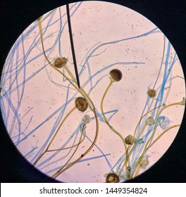 Gambar rhizopus stolonifer