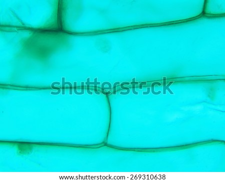 Rhode flagellate protozoa under a microscope (Allium Scale Euglena W.M.), 1000x