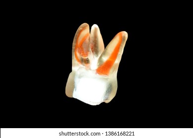 Right First Maxillary Upper Molar Tooth That Show Root Canal Anatomy