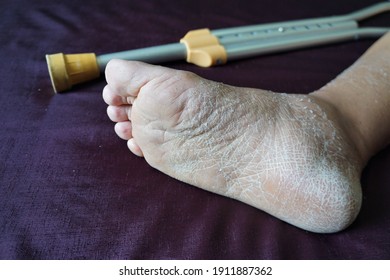 Cast Off Skin High Res Stock Images Shutterstock